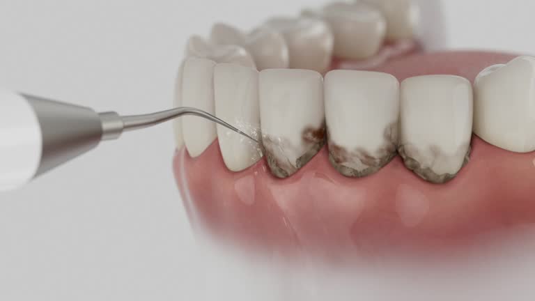 Reliable Dental Implants contractor in Monongah, WV by Smile Center Dentistry